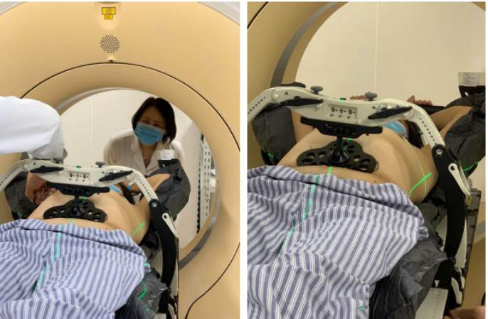 elekta infinity高端直线加速器提供了高精度,高舒适度的放疗定位基础
