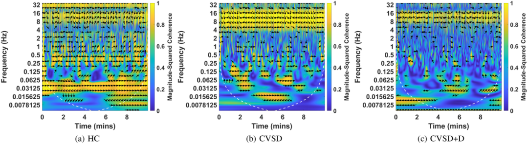 医研创见 | 精准捕捉「隐形」痴呆——我院神经内二科郭晓敏团队在认知障碍早期无创筛查领域取得显著进展