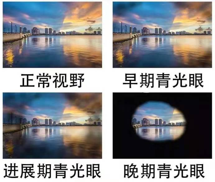 视野不丢生活无忧